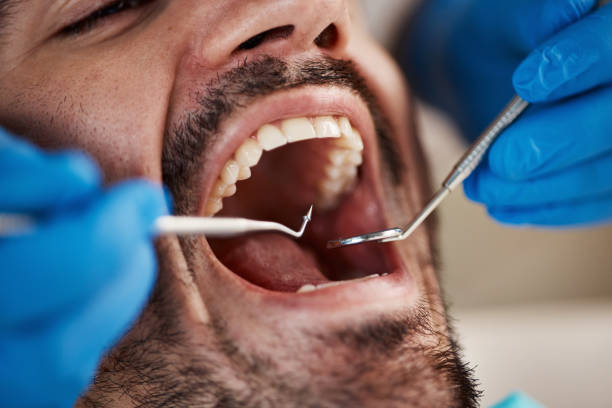 Oral Cancer Screening in Tiffin, OH